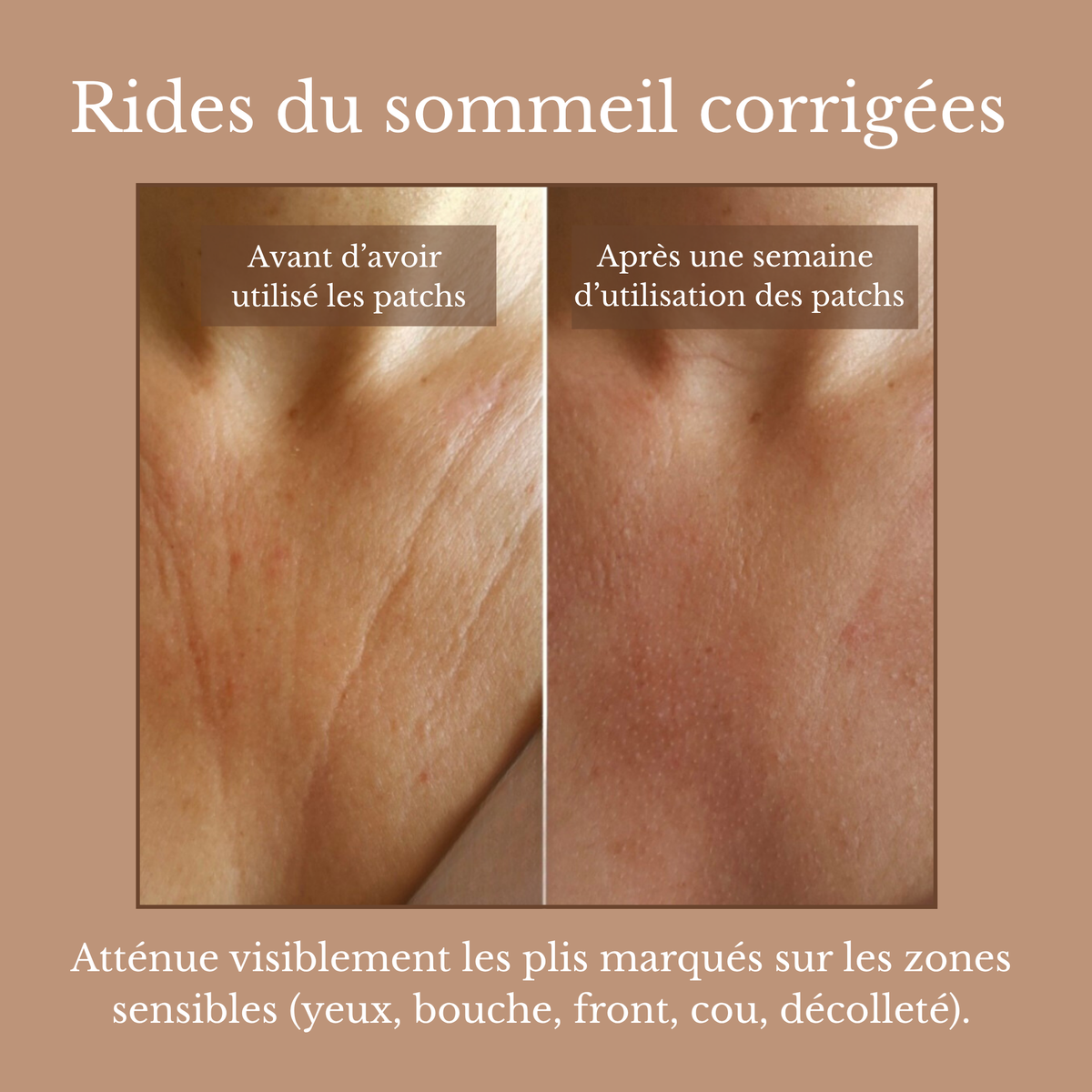 Lissée – Les patchs qui lissent les rides du sommeil pendant la nuit